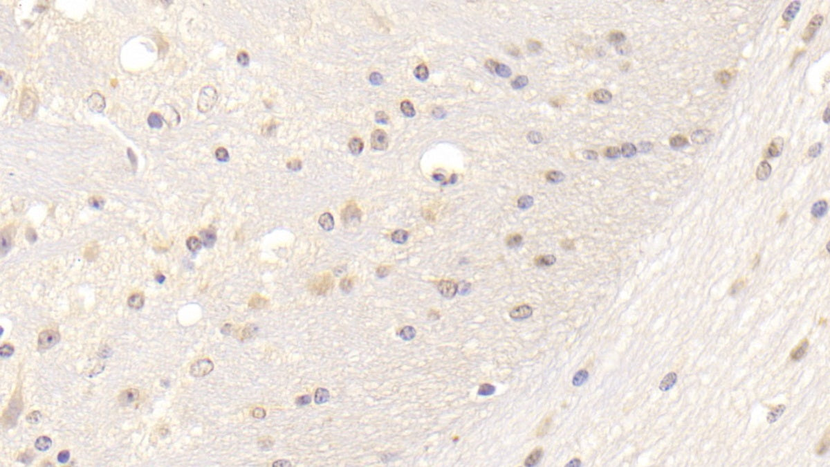 DAB staining on IHC-P; Samples: Mouse Colon Tissue; Primary Ab: 20μg/ml Rabbit Anti-Mouse LDLR Antibody Second Ab: 2µg/mL HRP-Linked Caprine Anti-Rabbit IgG Polyclonal Antibody