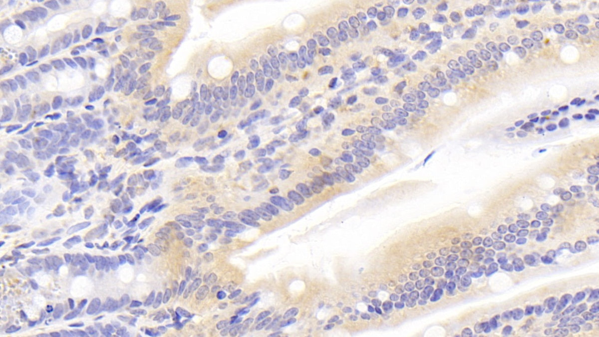 Low Density Lipoprotein Receptor (LDLR) Polyclonal Antibody - image 4