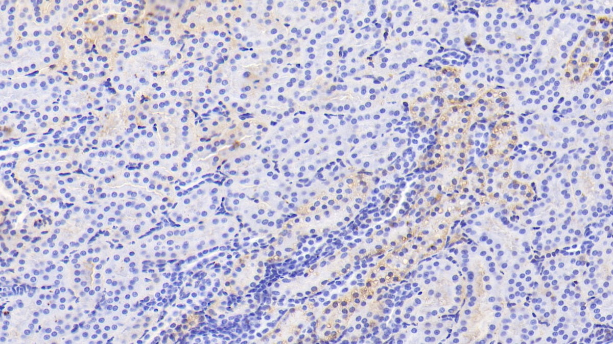 DAB staining on IHC-P; Samples: Human Cardiac Muscle Tissue;  Primary Ab: 20μg/ml Rabbit Anti-Human ALB Antibody Second Ab: 2µg/mL HRP-Linked Caprine Anti-Rabbit IgG Polyclonal Antibody