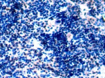 Protein Tyrosine Phosphatase Receptor Type C (CD45) Polyclonal Antibody - image 3