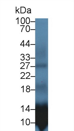 S100 Calcium Binding Protein A12 (S100A12) Polyclonal Antibody - image 2