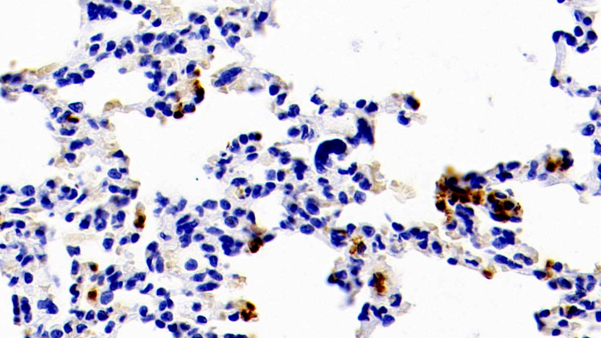 DAB staining on IHC-P; Samples: Rabbit Colon Tissue; Primary Ab: 10μg/ml Cavia Anti-Rabbit S100A12 Antibody Second Ab: 2µg/mL HRP-Linked Rabbit Anti-Cavia IgG Polyclonal Antibody
