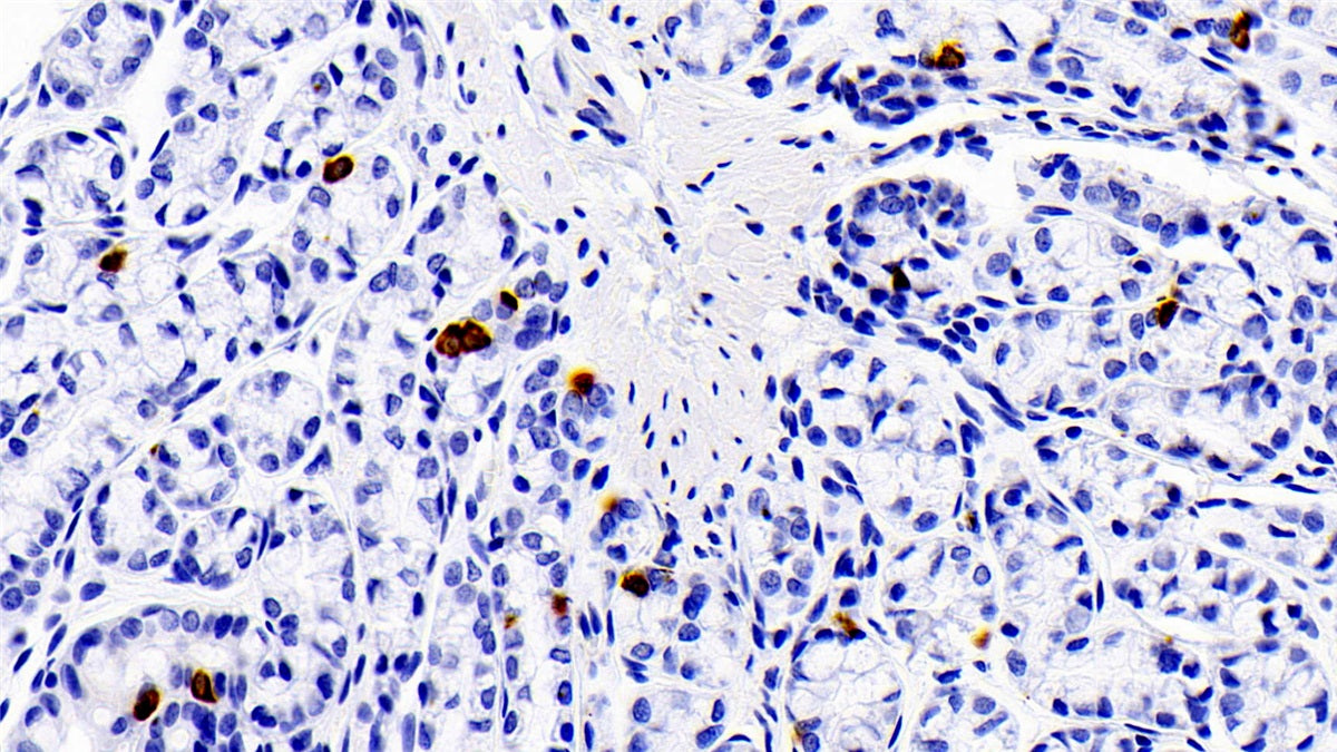 S100 Calcium Binding Protein A12 (S100A12) Polyclonal Antibody - image 4