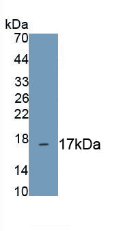 Metallothionein 1 (MT1) Polyclonal Antibody - image 2