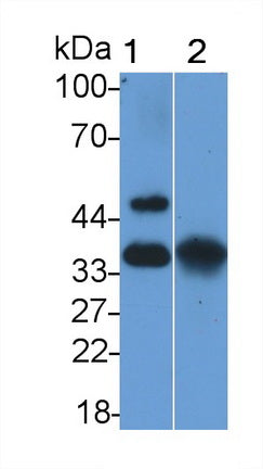 Epithelial Cell Adhesion Molecule (EPCAM) Polyclonal Antibody - image 2