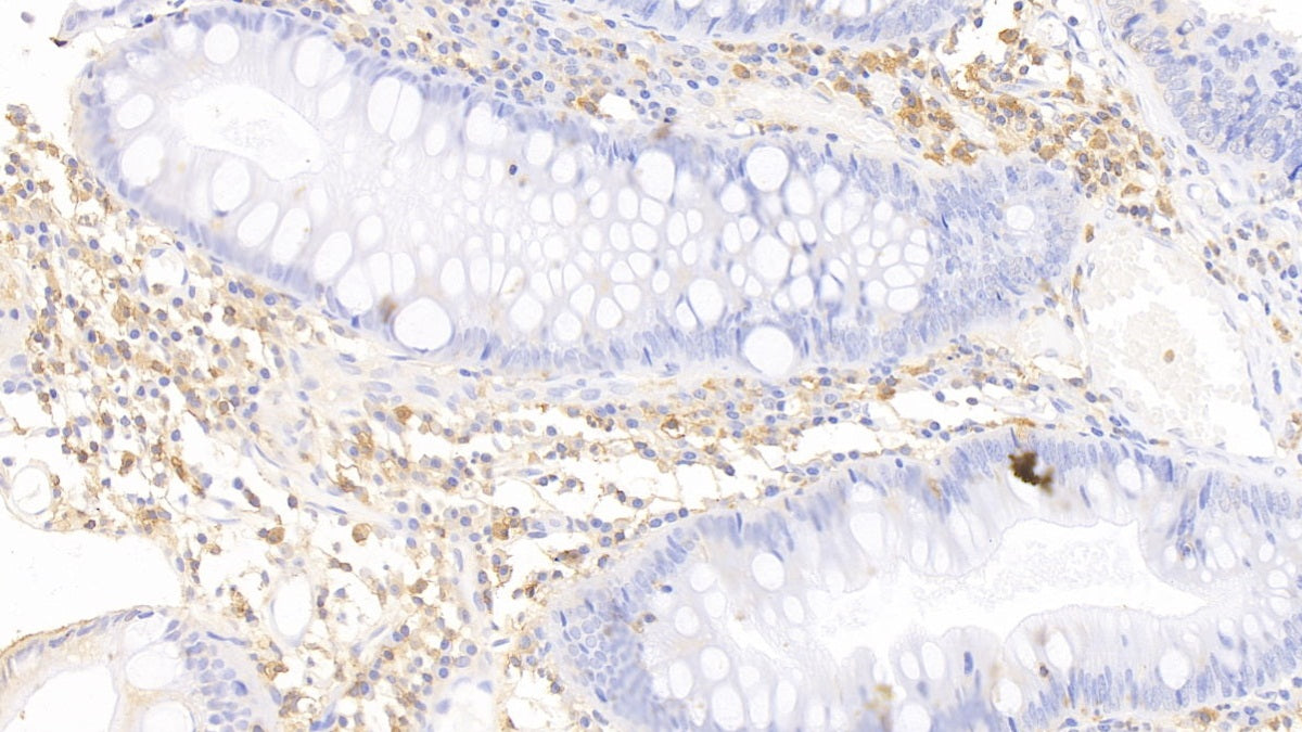 Epithelial Cell Adhesion Molecule (EPCAM) Polyclonal Antibody - image 3