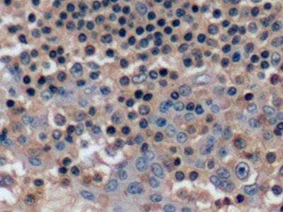 DAB staining on IHC-P; Samples: Human Kidney Tissue;  Primary Ab: 10µg/ml Rabbit Anti-Human ACTb Ant