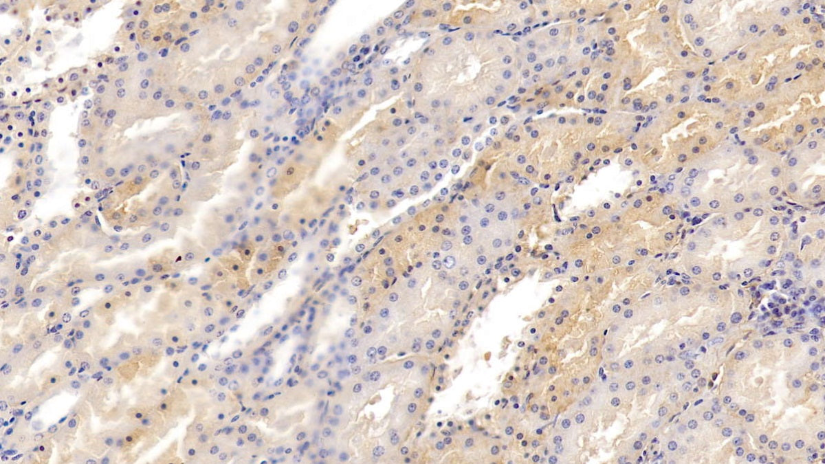 DAB staining on IHC-P; Samples: Porcine Liver Tissue;  Primary Ab: 20µg/ml Rabbit Anti-Porcine TRF Antibody Second Ab: 2µg/mL HRP-Linked Caprine Anti-Rabbit IgG Polyclonal Antibody