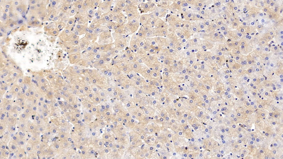 Transferrin (TF) Polyclonal Antibody - image 3