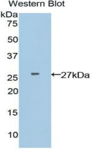 Adenomatosis Polyposis Coli Protein (APC) Polyclonal Antibody - image 2