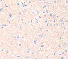Adenomatosis Polyposis Coli Protein (APC) Polyclonal Antibody - image 3