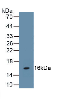 Follicle Stimulating Hormone Beta (FSHb) Polyclonal Antibody - image 2