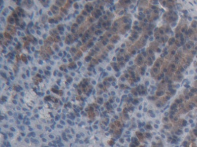 ATP Binding Cassette Transporter C11 (ABCC11) Polyclonal Antibody - image 2