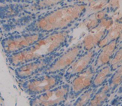Coenzyme A Synthase (COASY) Polyclonal Antibody - image 3