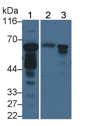 Acyl Coenzyme A Synthetase Medium Chain Family, Member 1 (ACSM1) Polyclonal Antibody - image 2