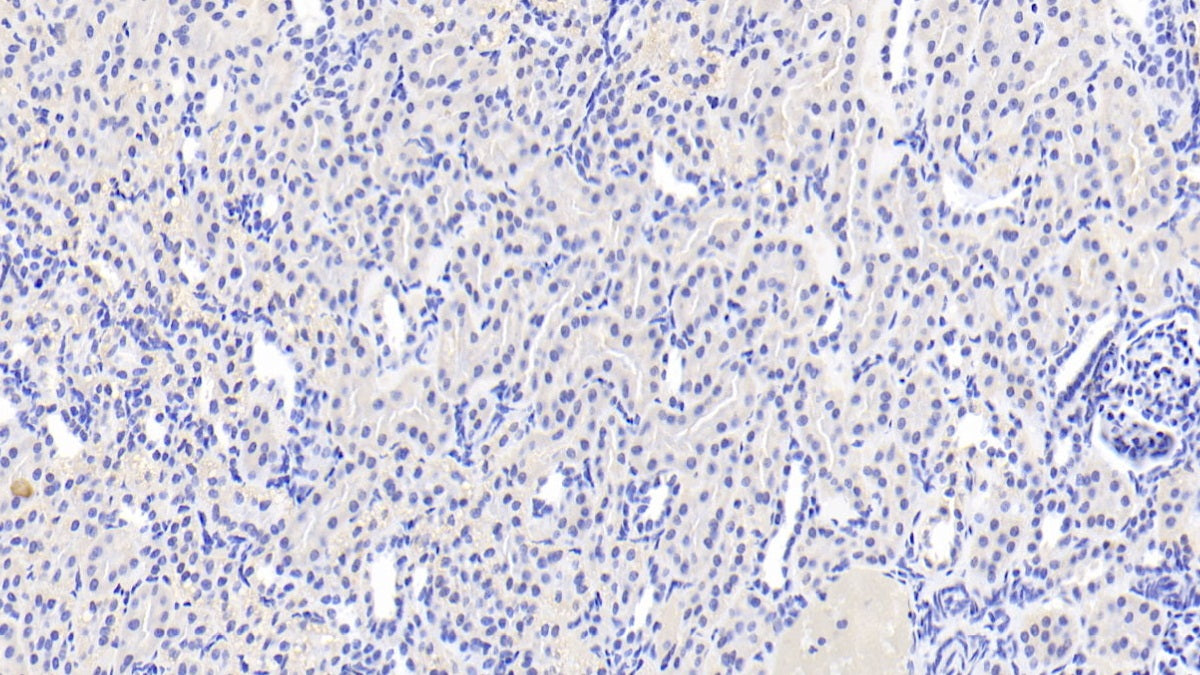 Acyl Coenzyme A Synthetase Medium Chain Family, Member 1 (ACSM1) Polyclonal Antibody - image 3