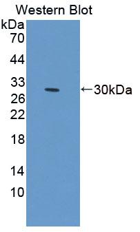 Phospholipase C Delta 1 (PLCd1) Polyclonal Antibody - image 2