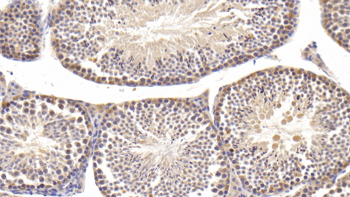 DAB staining on IHC-P; Samples: Mouse Cerebrum Tissue;  Primary Ab: 30µg/ml Rabbit Anti-Mouse PLCd1 Antibody Second Ab: 2µg/mL HRP-Linked Caprine Anti-Rabbit IgG Polyclonal Antibody