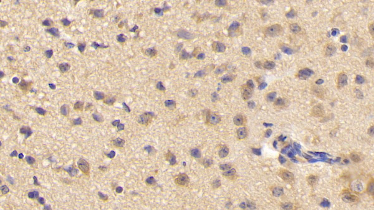 Phospholipase C Delta 1 (PLCd1) Polyclonal Antibody - image 4