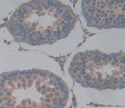 Phospholipase C Epsilon 1 (PLCe1) Polyclonal Antibody - image 3