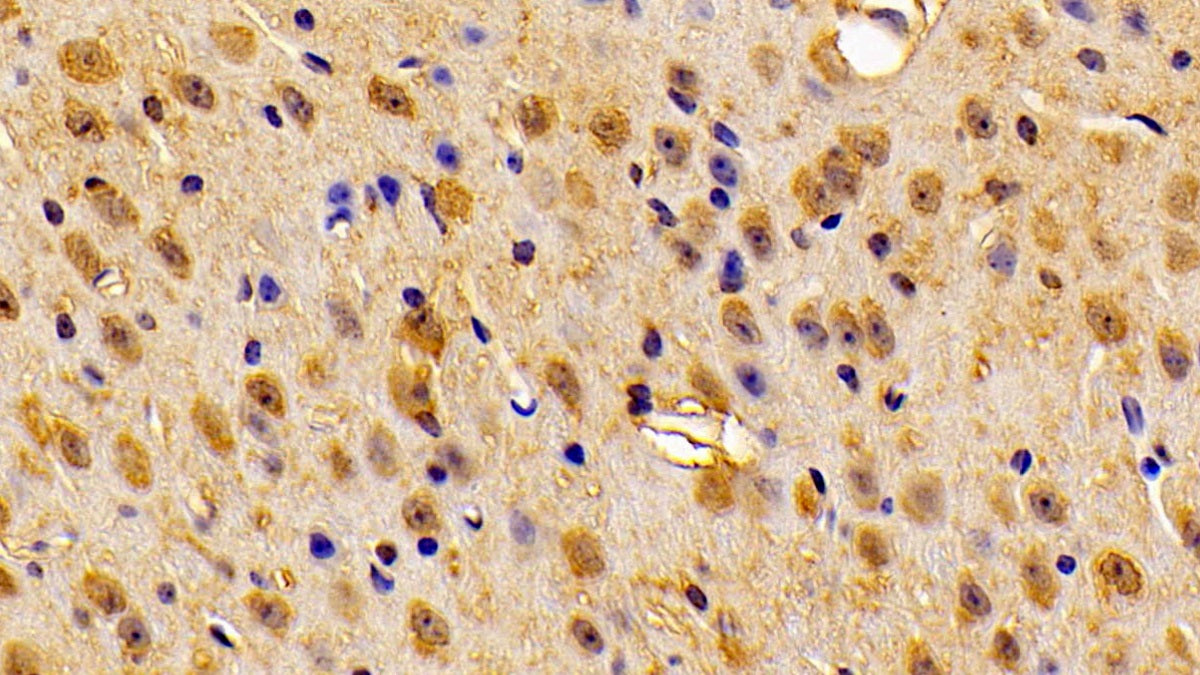 Calcyon Neuron Specific Vesicular Protein (CALY) Polyclonal Antibody - image 3