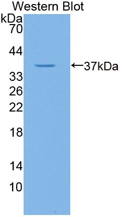 Gibbon Ape Leukemia Virus Receptor 1 (GLVR1) Polyclonal Antibody - image 2
