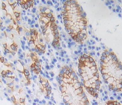 Gibbon Ape Leukemia Virus Receptor 1 (GLVR1) Polyclonal Antibody - image 3