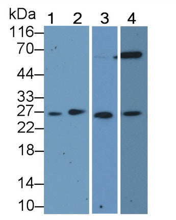 Cyclin Dependent Kinase Inhibitor 1B (CDKN1B) Polyclonal Antibody - image 2