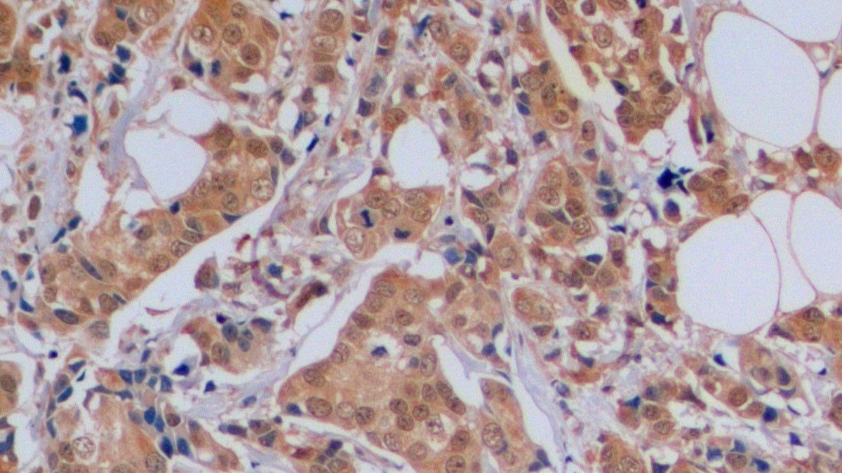 Cyclin Dependent Kinase Inhibitor 1B (CDKN1B) Polyclonal Antibody - image 3