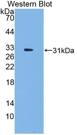 Cell Division Cycle Protein 7 (CDC7) Polyclonal Antibody - image 2