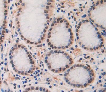 Cell Division Cycle Protein 7 (CDC7) Polyclonal Antibody - image 3