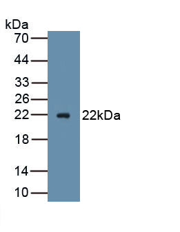 Advillin (AVIL) Polyclonal Antibody - image 2
