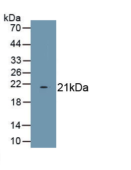 Translocation Associated Notch Homolog 1 (TAN1) Polyclonal Antibody - image 2