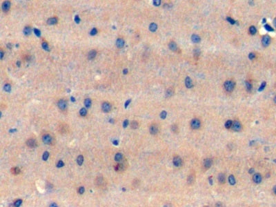 Translocation Associated Notch Homolog 1 (TAN1) Polyclonal Antibody - image 4