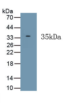 Hermansky Pudlak Syndrome Protein 6 (HPS6) Polyclonal Antibody - image 2