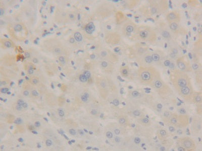 Signal Transducer And Activator Of Transcription 3 (STAT3) Polyclonal Antibody - image 3