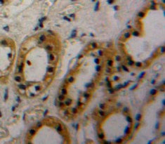 Western Blot; Sample: Recombinant THSD7A, Mouse.