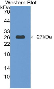 Thrombospondin Type I Domain Containing Protein 7A (THSD7A) Polyclonal Antibody - image 3