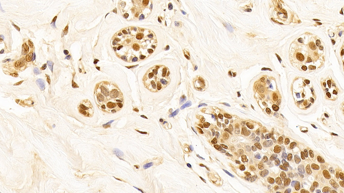 DAB staining on IHC-P; Sample: Human Stomach Tissue; Primary Ab: 10ug/ml Mouse Anti-Human GAPDH Antibody; Second Ab: 2ug/mL HRP-Linked Caprine Anti-Mouse IgG Polyclonal Antibody