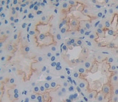 Western Blot; Sample: Recombinant BRP44L, Human.
