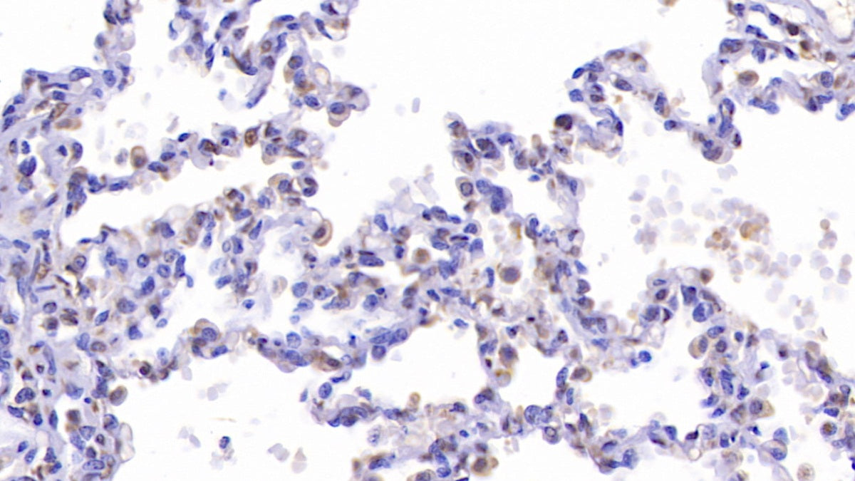 DAB staining on IHC-P; Samples: Human Kidney Tissue; Primary Ab: 10ug/ml Rabbit Anti-Human CFTR Antibody; Second Ab: 2ug/mL HRP-Linked Caprine Anti-Rabbit IgG Polyclonal Antibody