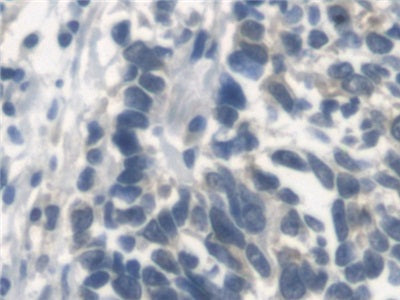 DAB staining on IHC-P; Samples: Human Kidney Tissue; Primary Ab: 20ug/ml Rabbit Anti-Human ErbB4 Antibody; Second Ab: 2ug/mL HRP-Linked Caprine Anti-Rabbit IgG Polyclonal Antibody