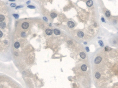 DAB staining on IHC-P; Samples: Human Esophagus Tissue; Primary Ab: 20ug/ml Rabbit Anti-Human ErbB4 Antibody; Second Ab: 2ug/mL HRP-Linked Caprine Anti-Rabbit IgG Polyclonal Antibody