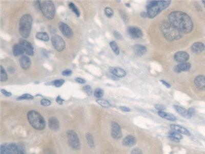 Erb-b2 Receptor Tyrosine Kinase 4 (ErbB4) Polyclonal Antibody - image 5