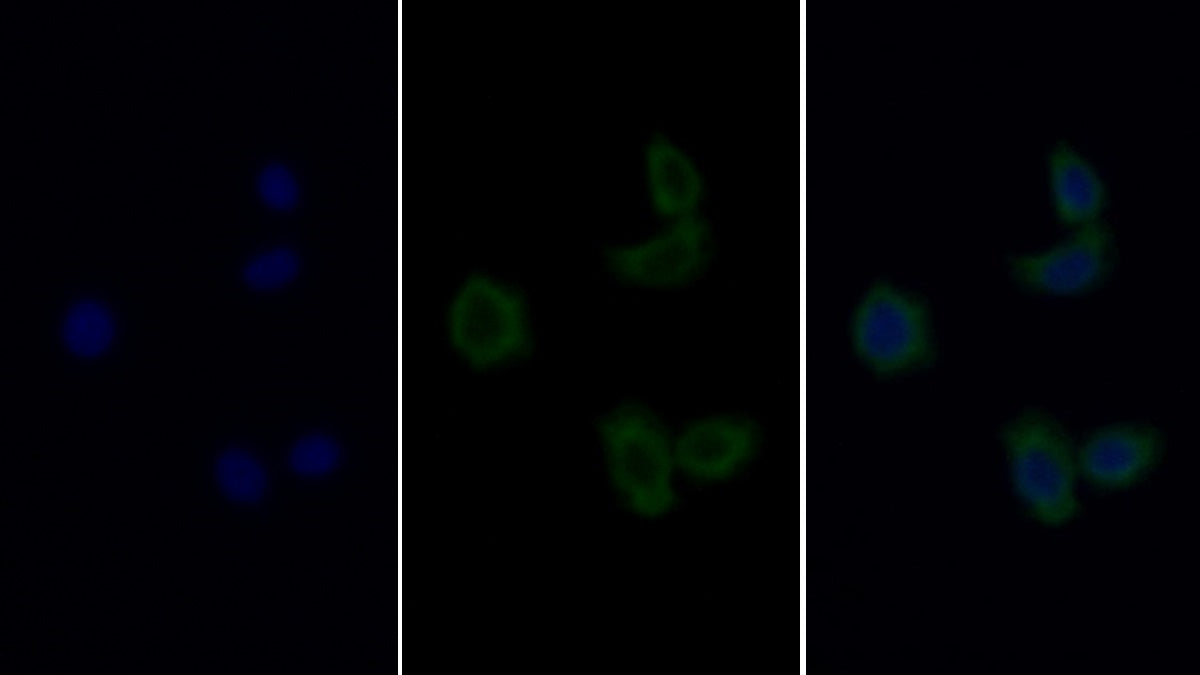 DAB staining on IHC-P; Sample: Human Cerebellum Tissue; Primary Ab: 20ug/ml Mouse Anti-Human PTEN Antibody; Second Ab: 2ug/mL HRP-Linked Caprine Anti-Mouse IgG Polyclonal Antibody