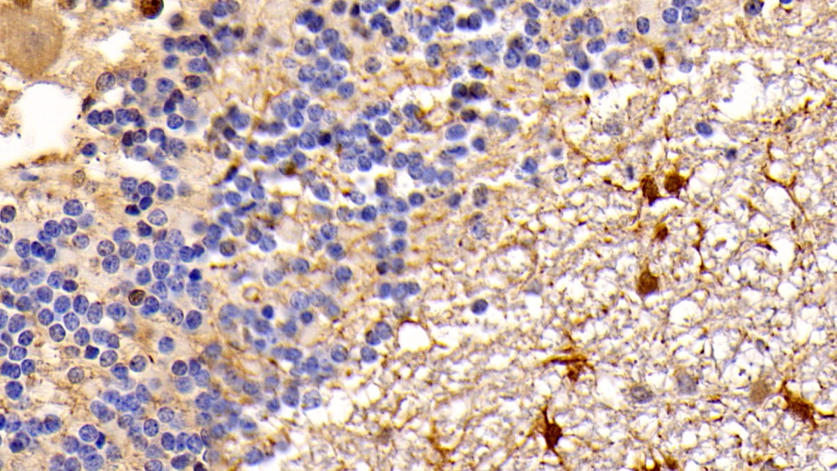 DAB staining on IHC-P; Sample: Human Cerebrum Tissue; Primary Ab: 20ug/ml Mouse Anti-Human PTEN Antibody; Second Ab: 2ug/mL HRP-Linked Caprine Anti-Mouse IgG Polyclonal Antibody