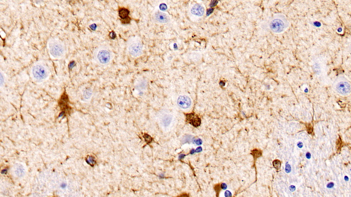 Western Blot; Sample: Hela cell lysate Primary Ab: 1ug/ml Mouse Anti-Human PTEN Antibody Second Ab: 0.2ug/mL HRP-Linked Caprine Anti-Mouse IgG Polyclonal Antibody