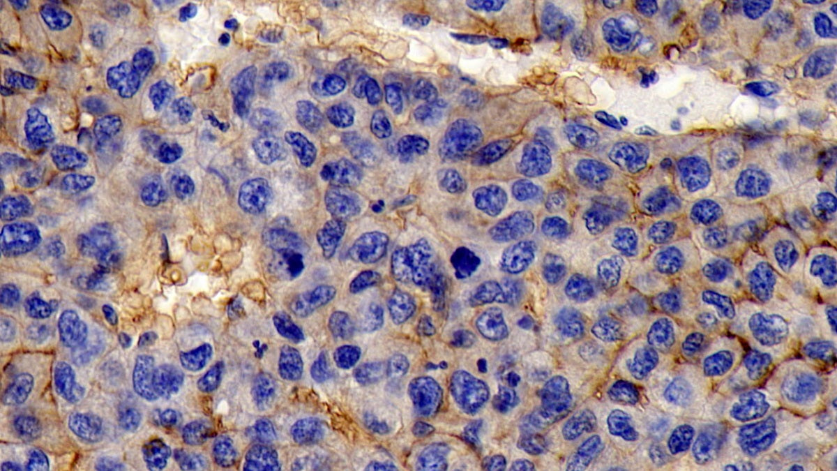 Cluster Of Differentiation 147 (CD147) Monoclonal Antibody - image 5