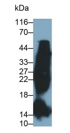 Glycated Hemoglobin A1c (HbA1c) Monoclonal Antibody - image 2