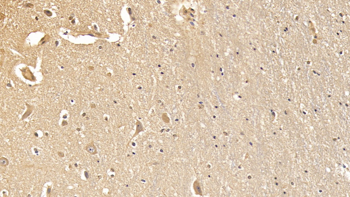 Western Blot; Sample: Lane1: Human Lung lysate; Lane2: Rat Cerebrum lysate; Lane3: Rat Testis lysate; Lane4: Hela cell lysate Primary Ab: 2ug/ml Mouse Anti-Human DMD Antibody Second Ab: 0.2ug/mL HRP-Linked Caprine Anti-Mouse IgG Polyclonal Antibody